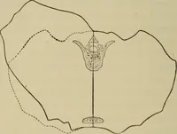 An illustration from The diagnostics of internal medicine : a clinical treatise upon the recognised principles of medical diagnosis, prepared for the use of students and practitioners of medicine / by Glentworth Reeve Butler ... ; with five coloured plates and two hundred and seventy-two illustrations and charts in the text. (1909)