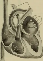 An illustration from The diagnostics of internal medicine : a clinical treatise upon the recognised principles of medical diagnosis, prepared for the use of students and practitioners of medicine / by Glentworth Reeve Butler ... ; with five coloured plates and two hundred and seventy-two illustrations and charts in the text. (1909)