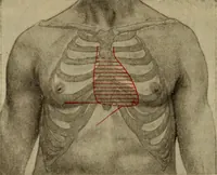 An illustration from The diagnostics of internal medicine : a clinical treatise upon the recognised principles of medical diagnosis, prepared for the use of students and practitioners of medicine / by Glentworth Reeve Butler ... ; with five coloured plates and two hundred and seventy-two illustrations and charts in the text. (1909)