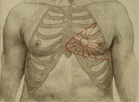 An illustration from The diagnostics of internal medicine : a clinical treatise upon the recognised principles of medical diagnosis, prepared for the use of students and practitioners of medicine / by Glentworth Reeve Butler ... ; with five coloured plates and two hundred and seventy-two illustrations and charts in the text. (1909)