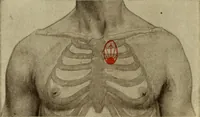 An illustration from The diagnostics of internal medicine : a clinical treatise upon the recognised principles of medical diagnosis, prepared for the use of students and practitioners of medicine / by Glentworth Reeve Butler ... ; with five coloured plates and two hundred and seventy-two illustrations and charts in the text. (1909)