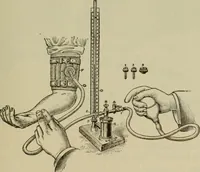 An illustration from The diagnostics of internal medicine : a clinical treatise upon the recognised principles of medical diagnosis, prepared for the use of students and practitioners of medicine / by Glentworth Reeve Butler ... ; with five coloured plates and two hundred and seventy-two illustrations and charts in the text. (1909)