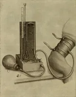 An illustration from The diagnostics of internal medicine : a clinical treatise upon the recognised principles of medical diagnosis, prepared for the use of students and practitioners of medicine / by Glentworth Reeve Butler ... ; with five coloured plates and two hundred and seventy-two illustrations and charts in the text. (1909)