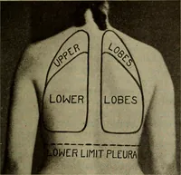 An illustration from The diagnostics of internal medicine : a clinical treatise upon the recognised principles of medical diagnosis, prepared for the use of students and practitioners of medicine / by Glentworth Reeve Butler ... ; with five coloured plates and two hundred and seventy-two illustrations and charts in the text. (1909)