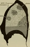 An illustration from The diagnostics of internal medicine : a clinical treatise upon the recognised principles of medical diagnosis, prepared for the use of students and practitioners of medicine / by Glentworth Reeve Butler ... ; with five coloured plates and two hundred and seventy-two illustrations and charts in the text. (1909)