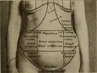 An illustration from The diagnostics of internal medicine : a clinical treatise upon the recognised principles of medical diagnosis, prepared for the use of students and practitioners of medicine / by Glentworth Reeve Butler ... ; with five coloured plates and two hundred and seventy-two illustrations and charts in the text. (1909)