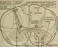 An illustration from The diagnostics of internal medicine : a clinical treatise upon the recognised principles of medical diagnosis, prepared for the use of students and practitioners of medicine / by Glentworth Reeve Butler ... ; with five coloured plates and two hundred and seventy-two illustrations and charts in the text. (1909)