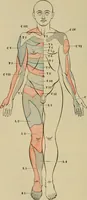 An illustration from The diagnostics of internal medicine : a clinical treatise upon the recognised principles of medical diagnosis, prepared for the use of students and practitioners of medicine / by Glentworth Reeve Butler ... ; with five coloured plates and two hundred and seventy-two illustrations and charts in the text. (1909)