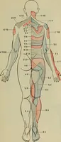 An illustration from The diagnostics of internal medicine : a clinical treatise upon the recognised principles of medical diagnosis, prepared for the use of students and practitioners of medicine / by Glentworth Reeve Butler ... ; with five coloured plates and two hundred and seventy-two illustrations and charts in the text. (1909)
