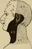 An illustration from The diagnostics of internal medicine : a clinical treatise upon the recognised principles of medical diagnosis, prepared for the use of students and practitioners of medicine / by Glentworth Reeve Butler ... ; with five coloured plates and two hundred and seventy-two illustrations and charts in the text. (1909)