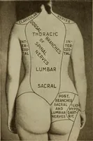 An illustration from The diagnostics of internal medicine : a clinical treatise upon the recognised principles of medical diagnosis, prepared for the use of students and practitioners of medicine / by Glentworth Reeve Butler ... ; with five coloured plates and two hundred and seventy-two illustrations and charts in the text. (1909)