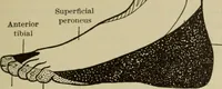 An illustration from The diagnostics of internal medicine : a clinical treatise upon the recognised principles of medical diagnosis, prepared for the use of students and practitioners of medicine / by Glentworth Reeve Butler ... ; with five coloured plates and two hundred and seventy-two illustrations and charts in the text. (1909)