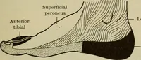 An illustration from The diagnostics of internal medicine : a clinical treatise upon the recognised principles of medical diagnosis, prepared for the use of students and practitioners of medicine / by Glentworth Reeve Butler ... ; with five coloured plates and two hundred and seventy-two illustrations and charts in the text. (1909)