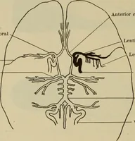 An illustration from The diagnostics of internal medicine : a clinical treatise upon the recognised principles of medical diagnosis, prepared for the use of students and practitioners of medicine / by Glentworth Reeve Butler ... ; with five coloured plates and two hundred and seventy-two illustrations and charts in the text. (1909)