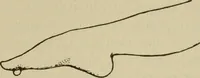 An illustration from The diagnostics of internal medicine : a clinical treatise upon the recognised principles of medical diagnosis, prepared for the use of students and practitioners of medicine / by Glentworth Reeve Butler ... ; with five coloured plates and two hundred and seventy-two illustrations and charts in the text. (1909)