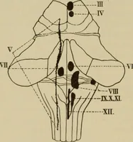 An illustration from The diagnostics of internal medicine : a clinical treatise upon the recognised principles of medical diagnosis, prepared for the use of students and practitioners of medicine / by Glentworth Reeve Butler ... ; with five coloured plates and two hundred and seventy-two illustrations and charts in the text. (1909)