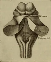 An illustration from The diagnostics of internal medicine : a clinical treatise upon the recognised principles of medical diagnosis, prepared for the use of students and practitioners of medicine / by Glentworth Reeve Butler ... ; with five coloured plates and two hundred and seventy-two illustrations and charts in the text. (1909)