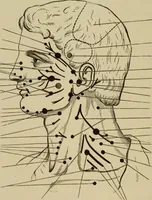 An illustration from The diagnostics of internal medicine : a clinical treatise upon the recognised principles of medical diagnosis, prepared for the use of students and practitioners of medicine / by Glentworth Reeve Butler ... ; with five coloured plates and two hundred and seventy-two illustrations and charts in the text. (1909)