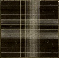 An illustration from The diagnostics of internal medicine : a clinical treatise upon the recognised principles of medical diagnosis, prepared for the use of students and practitioners of medicine / by Glentworth Reeve Butler ... ; with five coloured plates and two hundred and seventy-two illustrations and charts in the text. (1909)