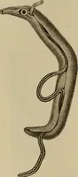 An illustration from The diagnostics of internal medicine : a clinical treatise upon the recognised principles of medical diagnosis, prepared for the use of students and practitioners of medicine / by Glentworth Reeve Butler ... ; with five coloured plates and two hundred and seventy-two illustrations and charts in the text. (1909)