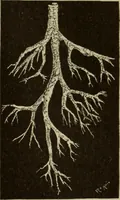 An illustration from The diagnostics of internal medicine : a clinical treatise upon the recognised principles of medical diagnosis, prepared for the use of students and practitioners of medicine / by Glentworth Reeve Butler ... ; with five coloured plates and two hundred and seventy-two illustrations and charts in the text. (1909)