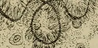 An illustration from The diagnostics of internal medicine : a clinical treatise upon the recognised principles of medical diagnosis, prepared for the use of students and practitioners of medicine / by Glentworth Reeve Butler ... ; with five coloured plates and two hundred and seventy-two illustrations and charts in the text. (1909)