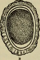 An illustration from The diagnostics of internal medicine : a clinical treatise upon the recognised principles of medical diagnosis, prepared for the use of students and practitioners of medicine / by Glentworth Reeve Butler ... ; with five coloured plates and two hundred and seventy-two illustrations and charts in the text. (1909)