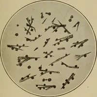 An illustration from The diagnostics of internal medicine : a clinical treatise upon the recognised principles of medical diagnosis, prepared for the use of students and practitioners of medicine / by Glentworth Reeve Butler ... ; with five coloured plates and two hundred and seventy-two illustrations and charts in the text. (1909)