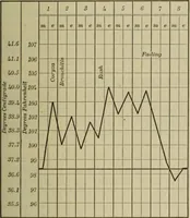 An illustration from The diagnostics of internal medicine : a clinical treatise upon the recognised principles of medical diagnosis, prepared for the use of students and practitioners of medicine / by Glentworth Reeve Butler ... ; with five coloured plates and two hundred and seventy-two illustrations and charts in the text. (1909)