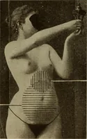 An illustration from The diagnostics of internal medicine : a clinical treatise upon the recognised principles of medical diagnosis, prepared for the use of students and practitioners of medicine / by Glentworth Reeve Butler ... ; with five coloured plates and two hundred and seventy-two illustrations and charts in the text. (1909)