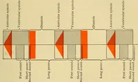 An illustration from Diseases of the heart and arterial system : designed to be a practical presentation of the subject for the use of students and practitioners of medicine / by Robert H. Babcock ; with three coloured plates and one hundred and thirty-nine illustrations. (1907)