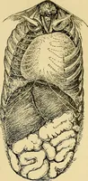 An illustration from Diseases of the heart and arterial system : designed to be a practical presentation of the subject for the use of students and practitioners of medicine / by Robert H. Babcock ; with three coloured plates and one hundred and thirty-nine illustrations. (1907)
