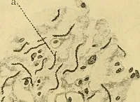 An illustration from A text-book of pathology for students of medicine / by J. George Adami and John McCrae ; illustrated with 304 engravings and 11 colored plates. (1912)