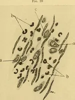 An illustration from A text-book of pathology for students of medicine / by J. George Adami and John McCrae ; illustrated with 304 engravings and 11 colored plates. (1912)
