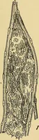 An illustration from A text-book of pathology for students of medicine / by J. George Adami and John McCrae ; illustrated with 304 engravings and 11 colored plates. (1912)