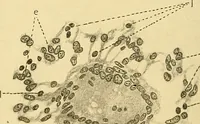 An illustration from A text-book of pathology for students of medicine / by J. George Adami and John McCrae ; illustrated with 304 engravings and 11 colored plates. (1912)