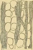An illustration from A text-book of pathology for students of medicine / by J. George Adami and John McCrae ; illustrated with 304 engravings and 11 colored plates. (1912)
