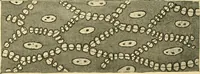 An illustration from A text-book of pathology for students of medicine / by J. George Adami and John McCrae ; illustrated with 304 engravings and 11 colored plates. (1912)