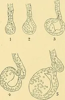An illustration from A text-book of pathology for students of medicine / by J. George Adami and John McCrae ; illustrated with 304 engravings and 11 colored plates. (1912)