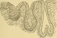 An illustration from A text-book of pathology for students of medicine / by J. George Adami and John McCrae ; illustrated with 304 engravings and 11 colored plates. (1912)