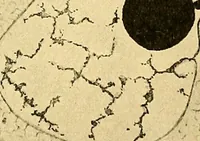 An illustration from A text-book of pathology for students of medicine / by J. George Adami and John McCrae ; illustrated with 304 engravings and 11 colored plates. (1912)