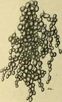 An illustration from A text-book of pathology for students of medicine / by J. George Adami and John McCrae ; illustrated with 304 engravings and 11 colored plates. (1912)
