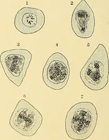 An illustration from A text-book of pathology for students of medicine / by J. George Adami and John McCrae ; illustrated with 304 engravings and 11 colored plates. (1912)