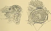 An illustration from A text-book of pathology for students of medicine / by J. George Adami and John McCrae ; illustrated with 304 engravings and 11 colored plates. (1912)