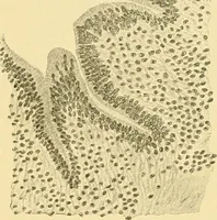 An illustration from A text-book of pathology for students of medicine / by J. George Adami and John McCrae ; illustrated with 304 engravings and 11 colored plates. (1912)