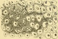 An illustration from A text-book of pathology for students of medicine / by J. George Adami and John McCrae ; illustrated with 304 engravings and 11 colored plates. (1912)