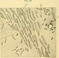 An illustration from A text-book of pathology for students of medicine / by J. George Adami and John McCrae ; illustrated with 304 engravings and 11 colored plates. (1912)