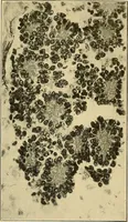 An illustration from A text-book of pathology for students of medicine / by J. George Adami and John McCrae ; illustrated with 304 engravings and 11 colored plates. (1912)