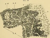 An illustration from A text-book of pathology for students of medicine / by J. George Adami and John McCrae ; illustrated with 304 engravings and 11 colored plates. (1912)