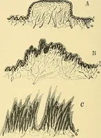 An illustration from A text-book of pathology for students of medicine / by J. George Adami and John McCrae ; illustrated with 304 engravings and 11 colored plates. (1912)